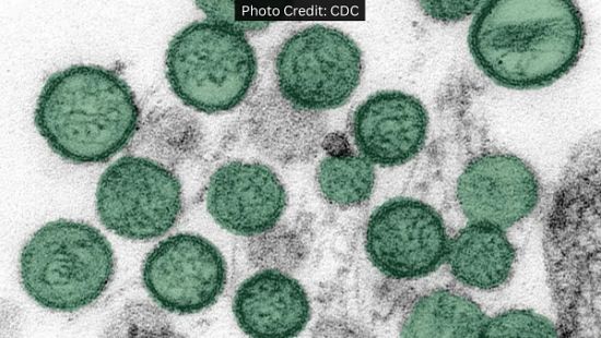 Microscopic image showing multiple round green virus particles (hantavirus) clustered against a gray textured background, labeled with photo credit to CDC.